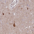 Anti-RHBDL2 Antibody