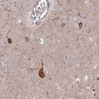 Anti-RHBDL2 Antibody