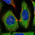 Immunofluorescent staining of human cell line U-2 OS shows localization to cytosol.
