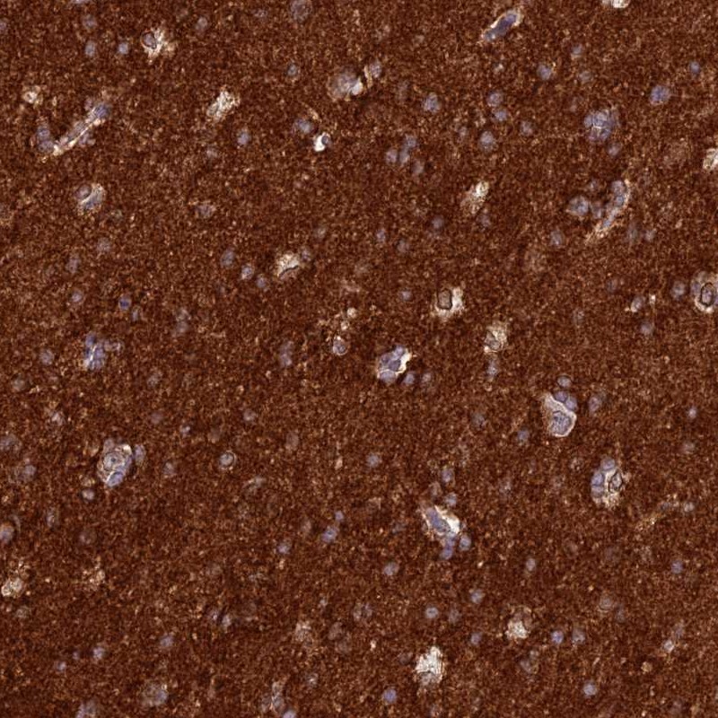 Anti-ST8SIA5 Antibody