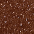 Anti-ST8SIA5 Antibody