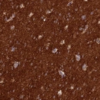 Anti-ST8SIA5 Antibody