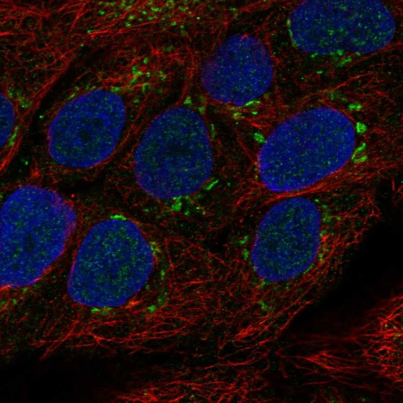 Anti-TMPRSS11E Antibody