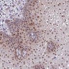 Anti-ANKRD52 Antibody