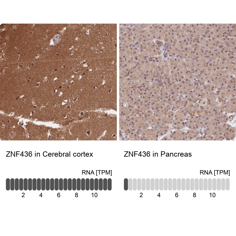 Anti-ZNF436 Antibody