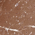 Immunohistochemical staining of human cerebral cortex shows high expression.
