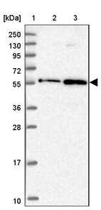 Lane 1: Marker [kDa] 250, 130, 95, 72, 55, 36, 28, 17, 10_br/_Lane 2: Human cell line RT-4_br/_Lane 3: Human cell line U-251MG sp