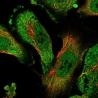 Immunofluorescent staining of human cell line U-251 MG shows localization to nucleoplasm & cytosol.