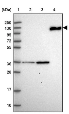 Lane 1: Marker [kDa] 250, 130, 95, 72, 55, 36, 28, 17, 10_br/_Lane 2: Human cell line RT-4_br/_Lane 3: Human cell line U-251MG sp_br/_Lane 4: Human plasma (IgG/HSA depleted)