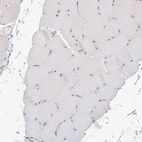 Immunohistochemical staining of human skeletal muscle shows low expression as expected.