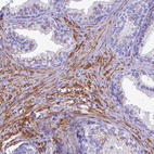Immunohistochemical staining of human Prostate shows strong granular cytoplasmic positivity in smooth muscle cells.