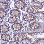 Immunohistochemical staining of human Colon shows moderate granular cytoplasmic positivity in glandular cells.