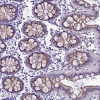 Immunohistochemical staining of human Colon shows moderate granular cytoplasmic positivity in glandular cells.