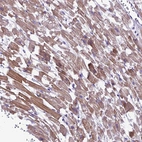 Immunohistochemical staining of human Heart muscle shows moderate cytoplasmic positivity in cardiomyocytes.