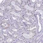 Immunohistochemical staining of human Kidney shows weak granular cytoplasmic positivity in cells in tubules.