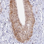 Anti-VSTM2L Antibody