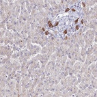 Anti-C1orf123 Antibody