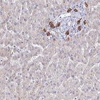 Anti-C1orf123 Antibody