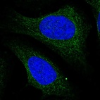 Immunofluorescent staining of human cell line U-2 OS shows localization to cytosol.