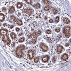Anti-TCEA2 Antibody