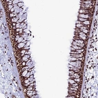 Anti-PPP4C Antibody