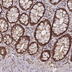 Immunohistochemical staining of human rectum shows strong nuclear and cytoplasmic positivity in glandular cells.