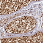 Immunohistochemical staining of human testis shows strong nuclear and cytoplasmic positivity in cells in seminiferous ducts and leydig cells.