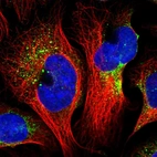 Immunofluorescent staining of human cell line U-2 OS shows localization to vesicles.
