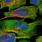 Immunofluorescent staining of human cell line U-2 OS shows localization to plasma membrane & cytosol.