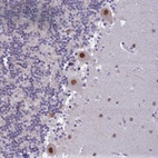 Anti-C2orf49 Antibody