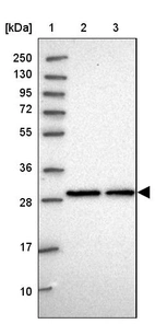 Lane 1: Marker [kDa] 250, 130, 95, 72, 55, 36, 28, 17, 10_br/_Lane 2: Human cell line RT-4_br/_Lane 3: Human cell line U-251MG sp