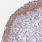 Anti-IER3 Antibody
