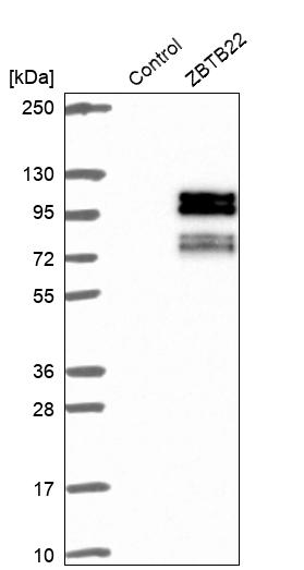 Anti-ZBTB22 Antibody
