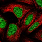 Immunofluorescent staining of human cell line U-2 OS shows localization to nucleoplasm.