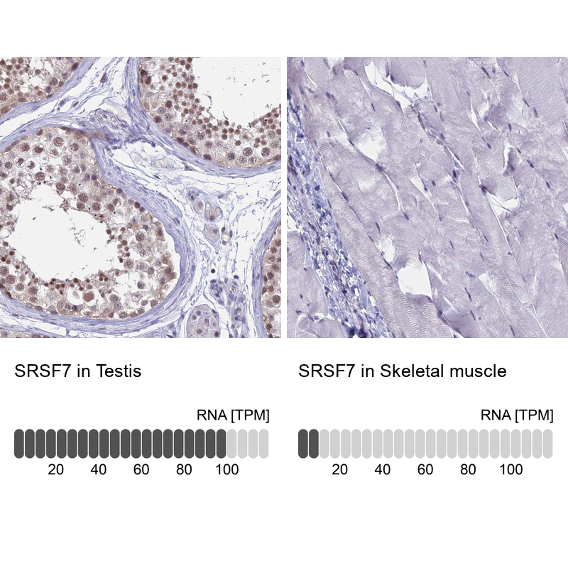 Anti-SRSF7 Antibody