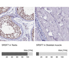 Anti-SRSF7 Antibody