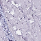 Immunohistochemical staining of human skeletal muscle shows low expression as expected.