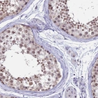 Immunohistochemical staining of human testis shows high expression.