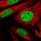 Immunofluorescent staining of human cell line U-2 OS shows localization to nucleoplasm.