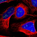 Immunofluorescent staining of human cell line U-2 OS shows localization to nucleoli fibrillar center.