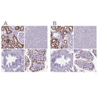 Immunohistochemical staining of human kidney, liver, prostate and small intestine using Anti-CUBN antibody HPA043854 (A) shows similar protein distribution across tissues to independent antibody HPA004133 (B).