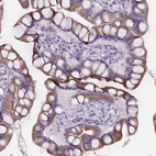 Immunohistochemical staining of human small intestine shows weak to moderate cytoplasmic positivity in glandular cells.