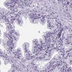 Immunohistochemical staining of human prostate shows no positivity in glandular cells as expected.