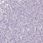 Immunohistochemical staining of human liver shows no positivity in hepatocytes as expected.