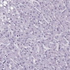 Immunohistochemical staining of human liver shows no positivity in hepatocytes as expected.
