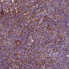 Anti-TAS2R38 Antibody