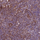 Anti-TAS2R38 Antibody
