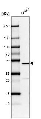Anti-VPS13B Antibody