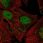 Immunofluorescent staining of human cell line U-2 OS shows localization to nucleoplasm, plasma membrane & focal adhesion sites.