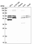 Anti-TXNRD1 Antibody